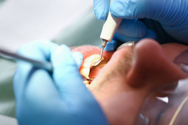 Best Emergency Denture Repair in Four Cners, OR